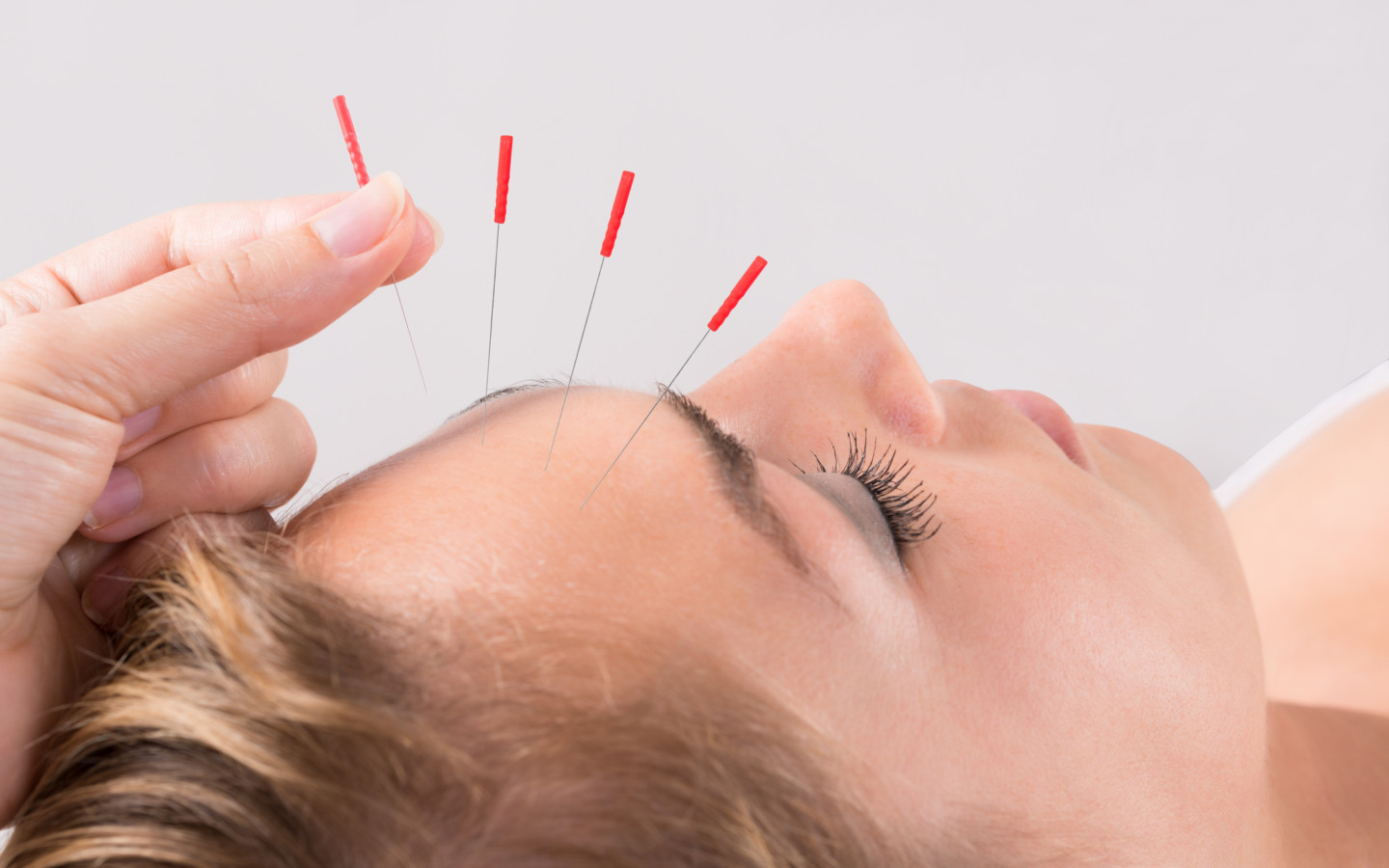 Acupuncture is a holistic lifestyle service